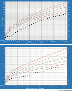 Growth charts (longitudinal height and weight) from birth to 5 years of age.