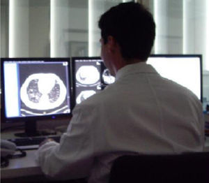 Workstation with three monitors as a bad example of position and lighting. The screen is too low, when the appropriate would be that the top of the screen is at eye level to avoid forced postures and the associated muscle lesions. Ambient lighting, instead of being fluorescence and indirect, is in front of the user which can have a negative influence in detail appreciation.