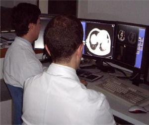 Correct positioning of a listener, seated behind and aside the radiologist, to avoid distractions. Wall colors in this case are not suitable; dark and matt colors to avoid light glaring are recommended.