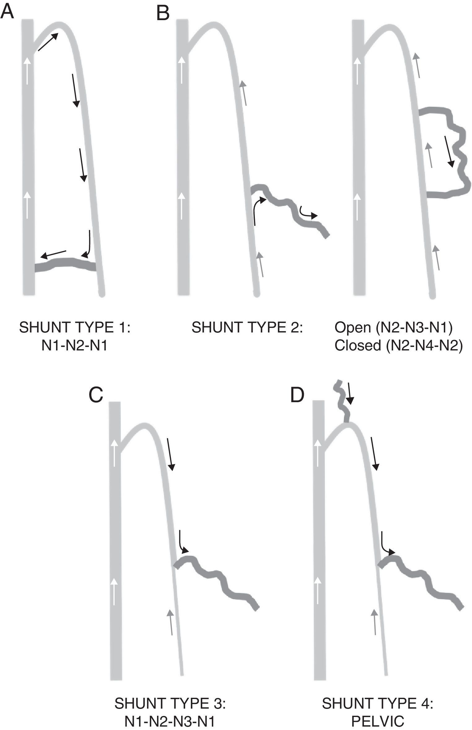 Doppler ultrasound study and venous mapping in chronic venous ...