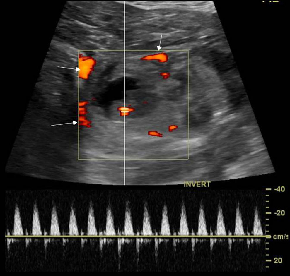Gynecological pelvic pain as emergency pathology | Radiología (English ...