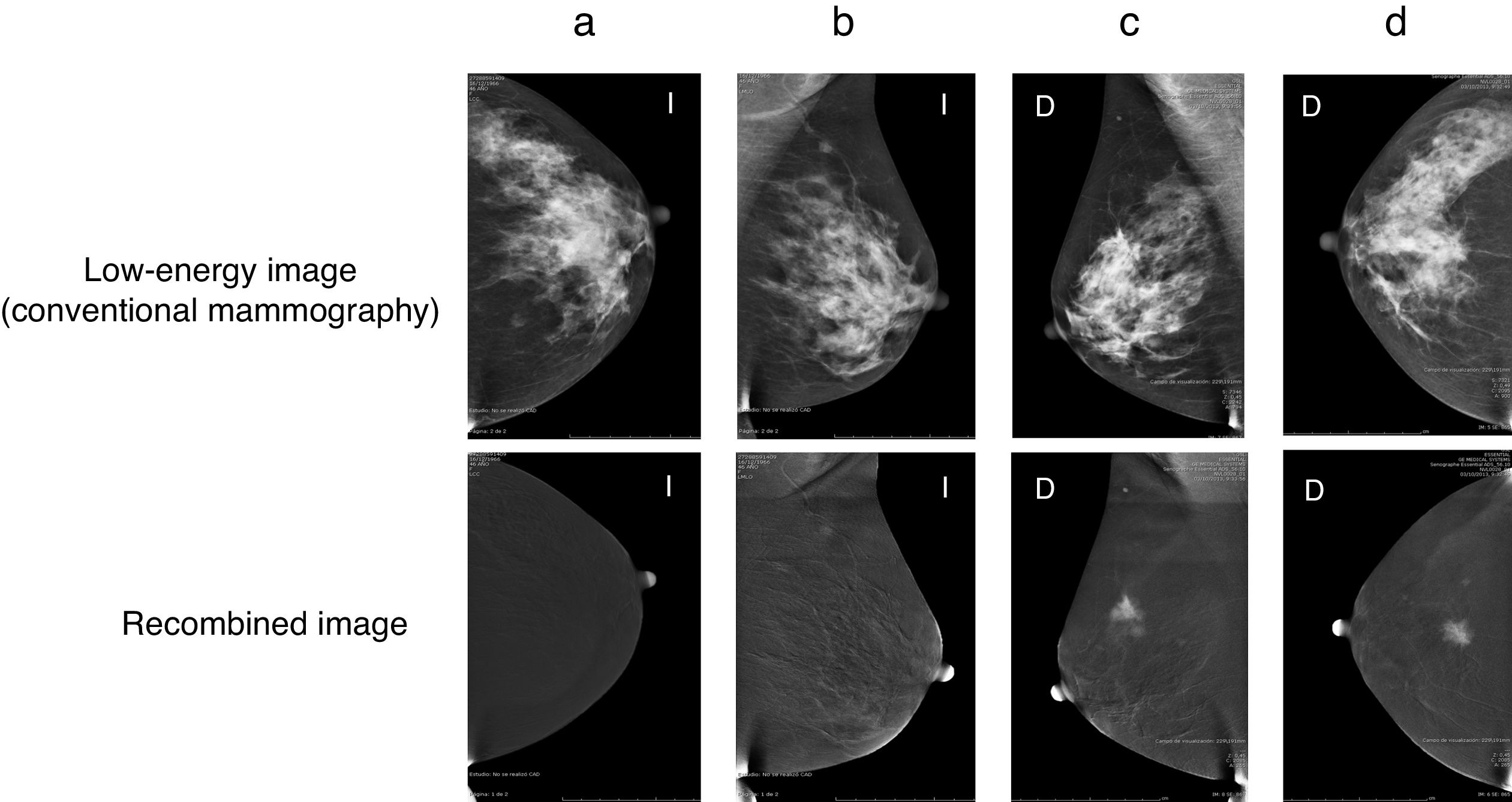 Evaluation of the applicability of BI-RADS® MRI for the interpretation ...