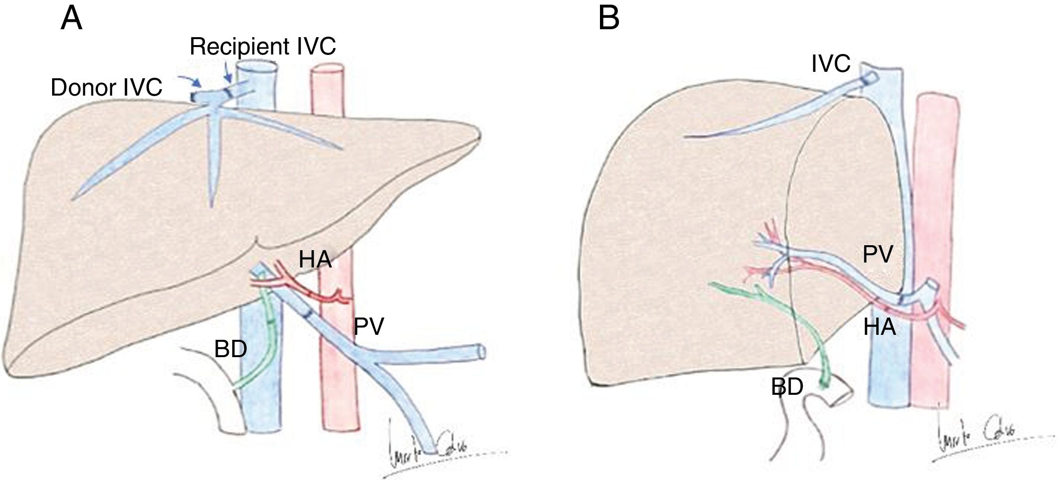 Normal and transitory ultrasonography findings in the immediate ...