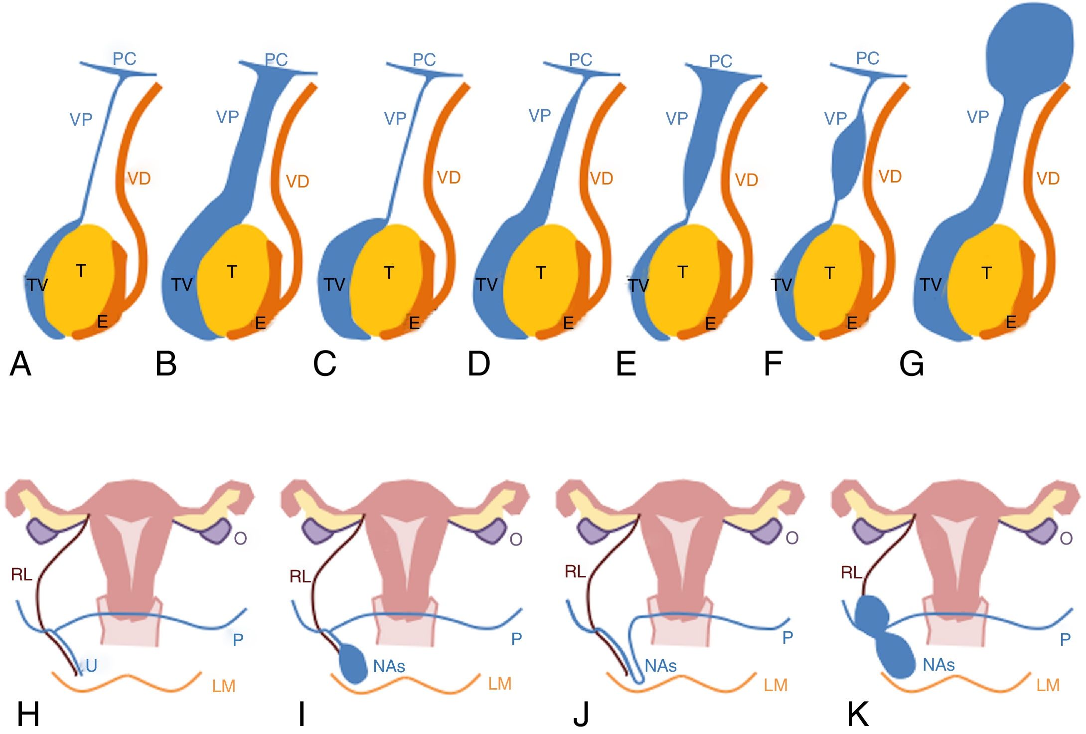 Hydrocleses Paediatric groin lesions: Imaging findings | Radiología (English Edition)