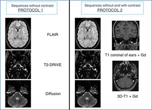 Sequences included in the protocols without and with gadolinium.