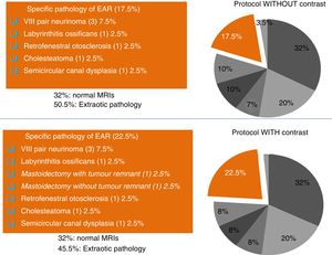 Reading of the images by the neuroradiologist, without and with IVC (intravenous contrast).