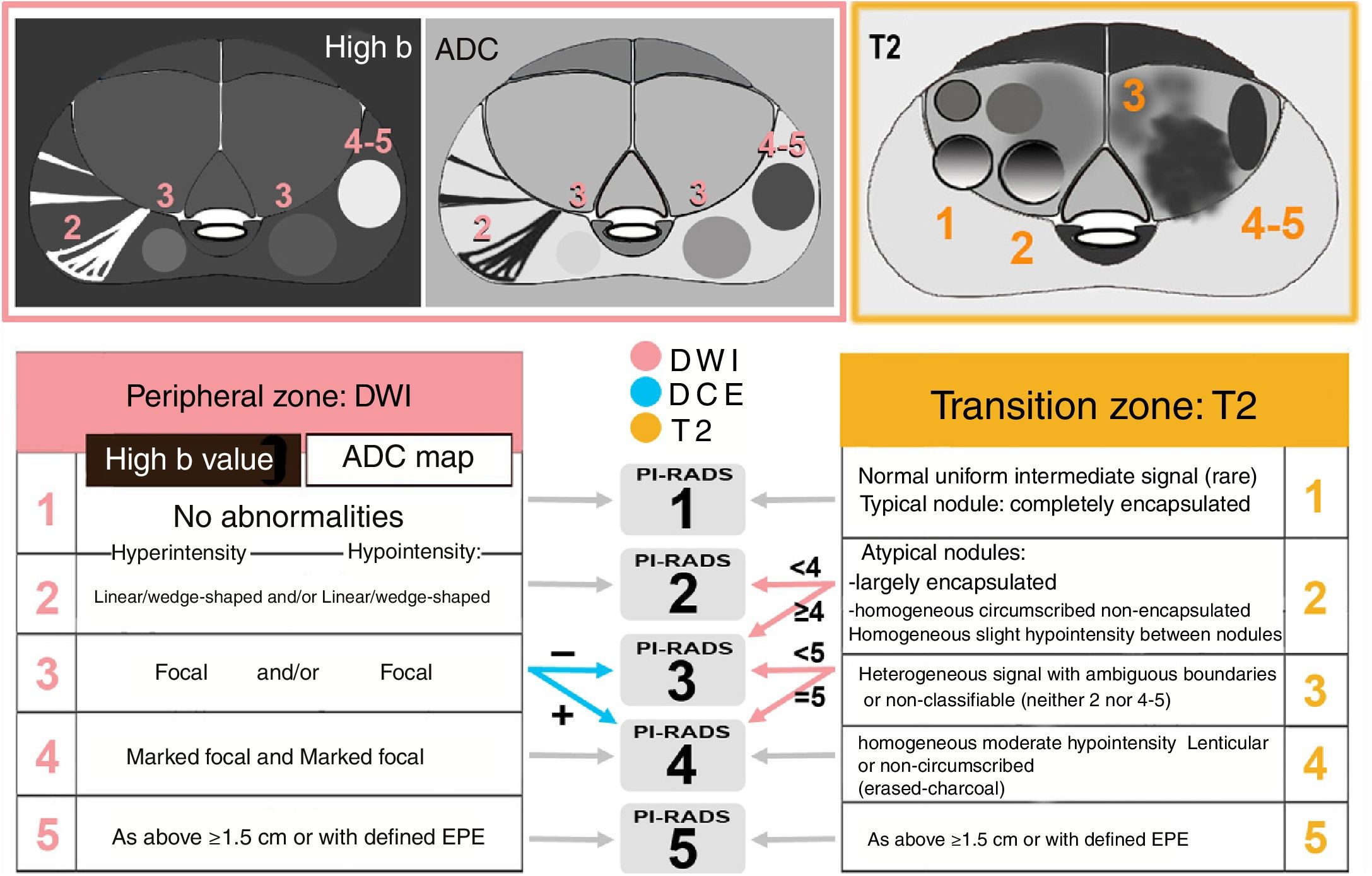 Prostate MRI: Practical guidelines for interpreting and reporting ...