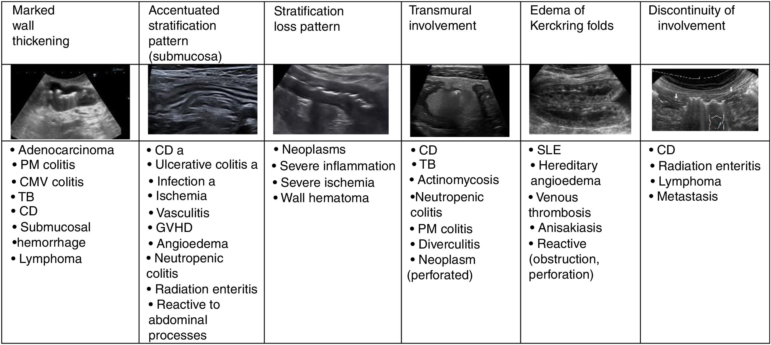 Bowel ultrasound: Examination techniques and normal and pathologic ...