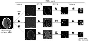 Example with an image: an example is shown in which an image from a CT scan of the brain passes through successive layers that contain three 3 × 3 filters and the pooling function, yielding different feature maps with lower and lower spatial resolution. The greater the depth in the network, the more coarse-grained and smaller the maps, with forward propagation of only the most important information.
