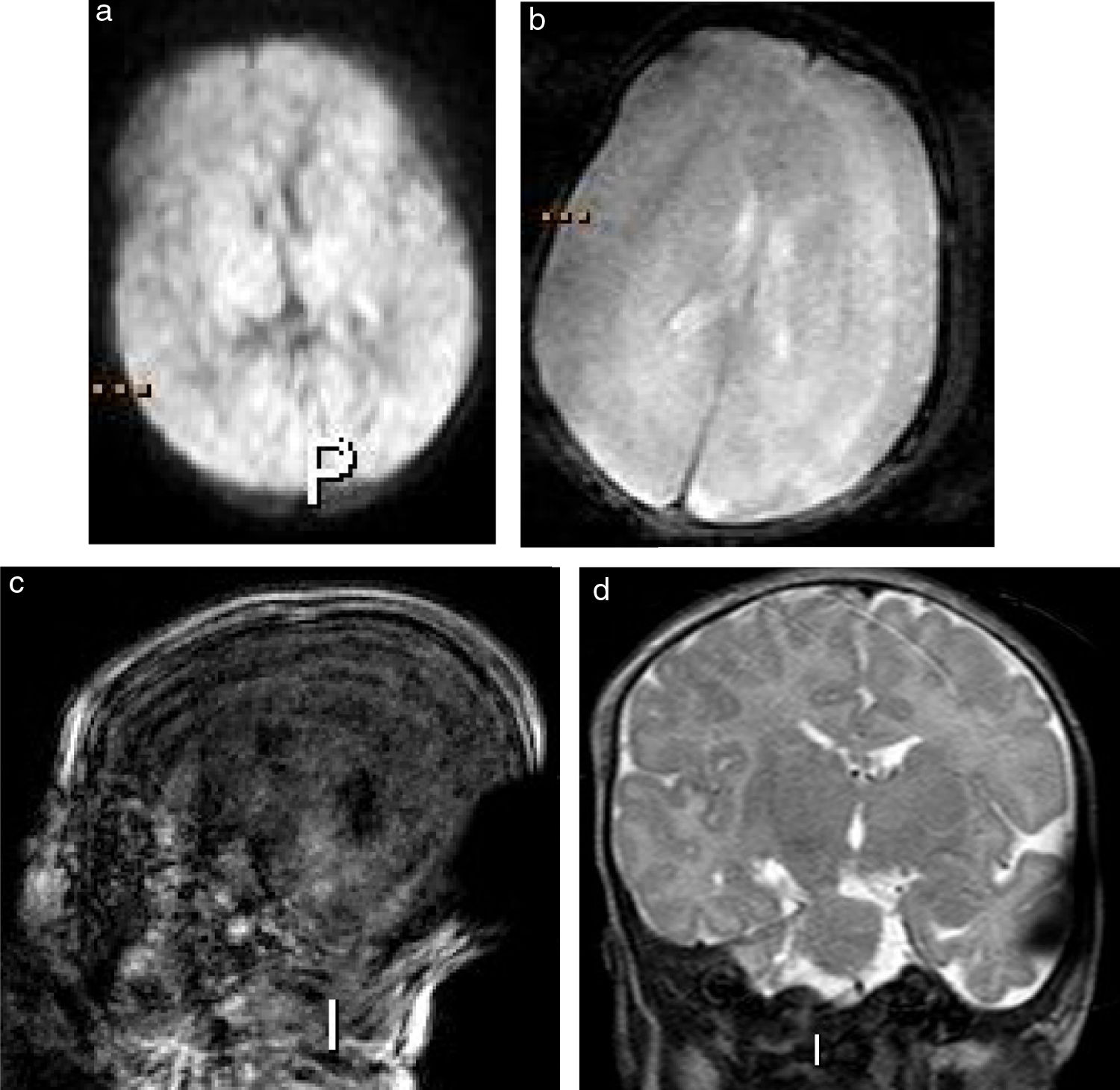 Brain MRI without anesthesia in children less than 3 months old ...