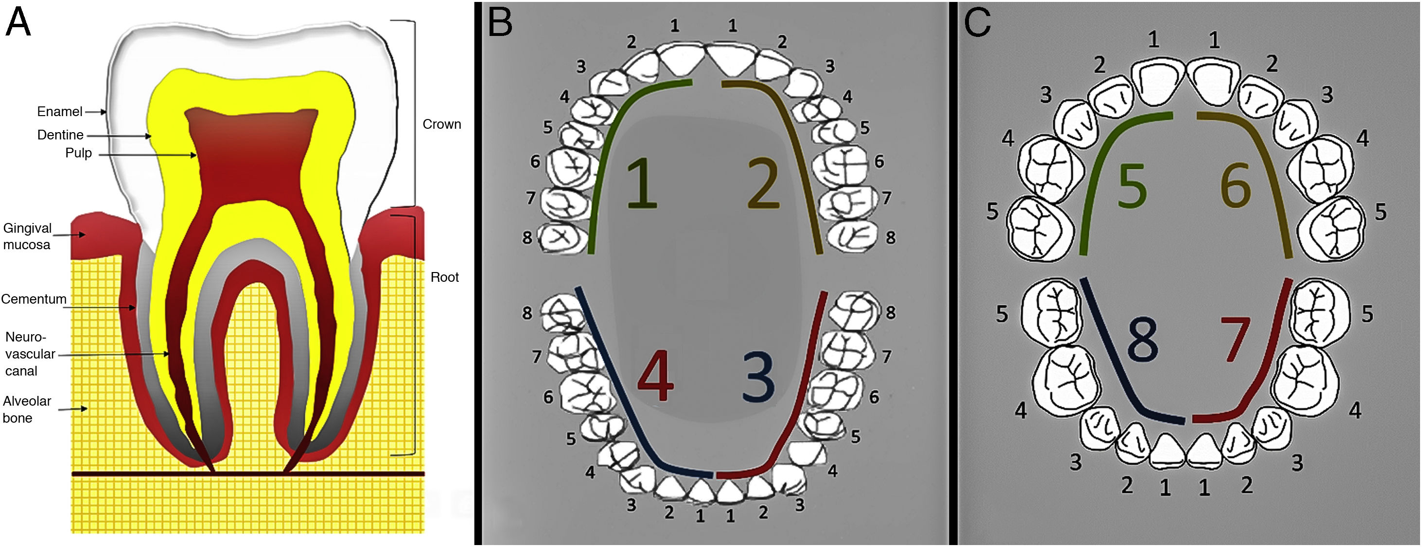 CT findings for dental disease | Radiología (English Edition)
