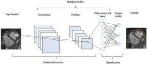 Example of a Convolutional Neural Network structure. Source: Fotaki et al.10