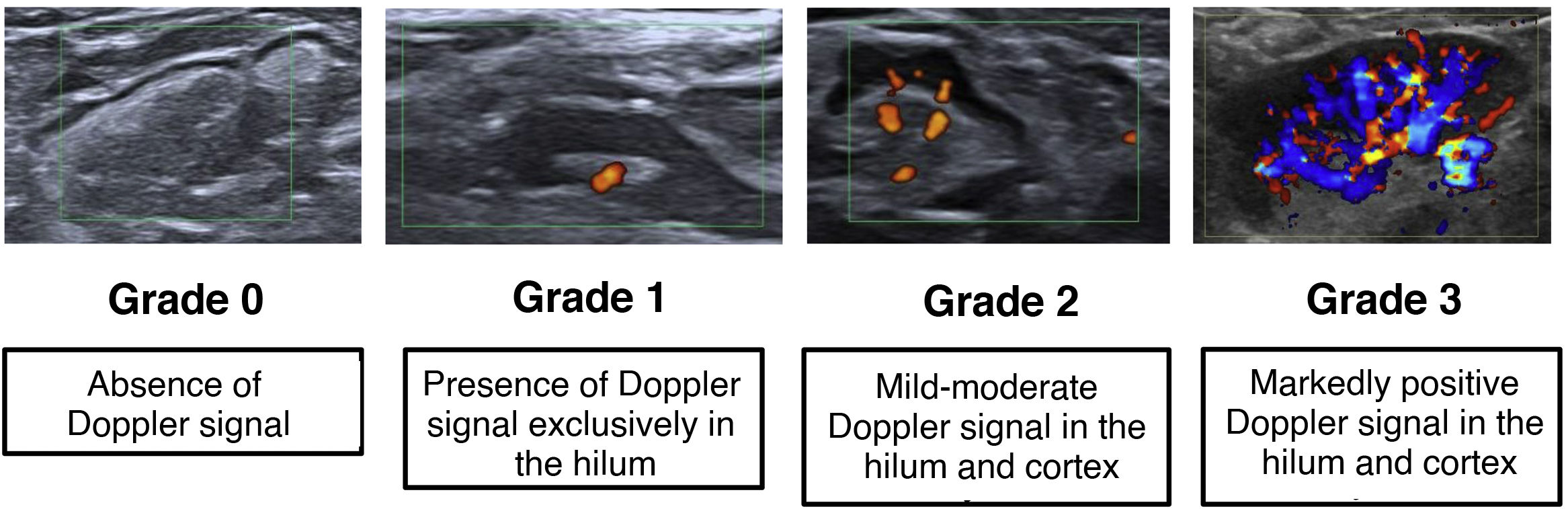 Ultrasound imaging of the normal axilla: Anatomical characteristics of ...