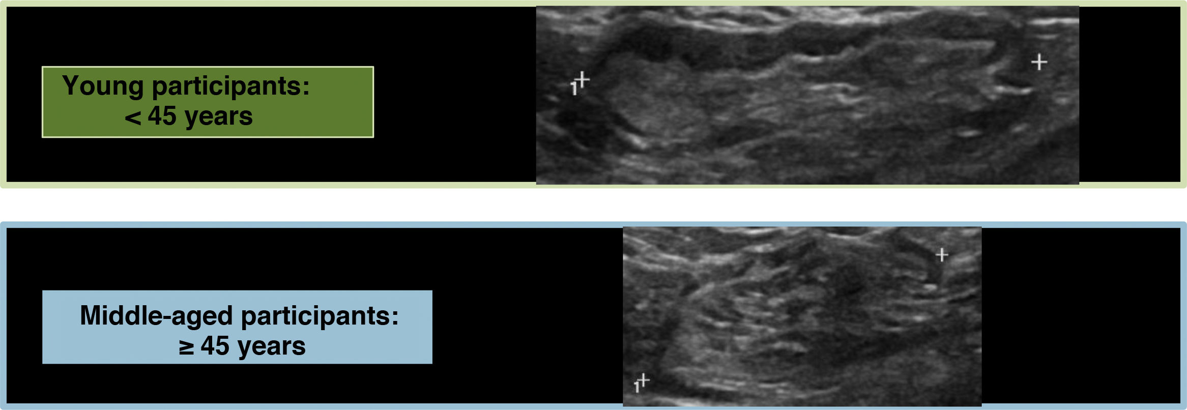 Ultrasound imaging of the normal axilla: Anatomical characteristics of ...