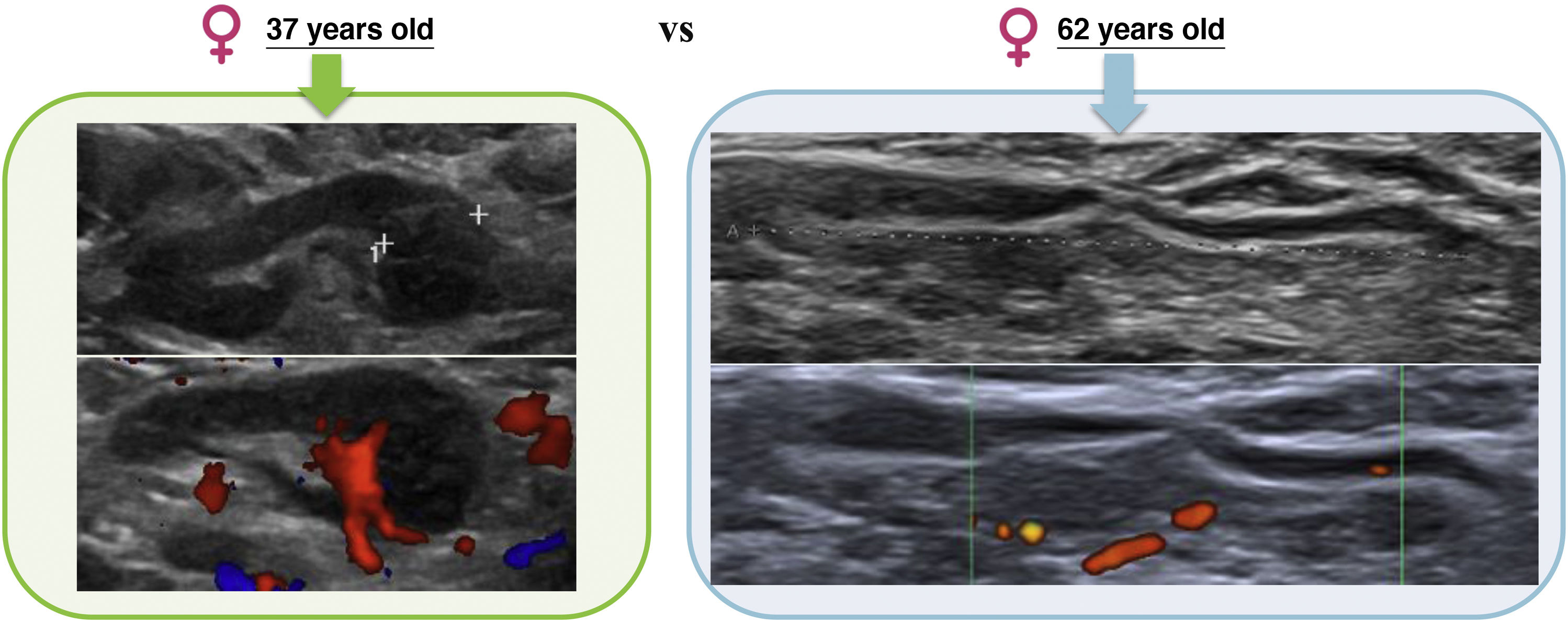 Ultrasound imaging of the normal axilla: Anatomical characteristics of ...