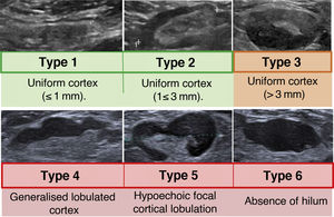 Ultrasound imaging of the normal axilla: Anatomical characteristics of ...