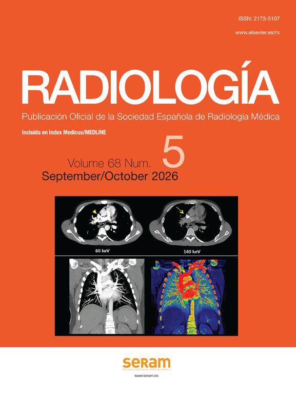 Radiología (English Edition)