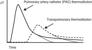 Comparison of the thermal variation curve over time registered by the thermistor of a pulmonary artery catheter (solid line) and the arterial thermistor of the PiCCO system (broken line). Note the difference in transit time due to the distance from the injection point to both temperature sensors.