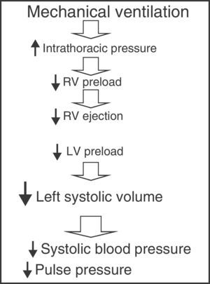 Principal hemodynamic effects of the application of mechanical ventilation.