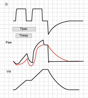 Double cycling in volume-controlled ventilation. When the Ti of the patient (Tipac) is greater than the Ti of the ventilator or respirator (Tiresp), the patient continues inspiration against the already closed inspiratory valve, causing the drop of Paw and, if the triggering threshold is exceeded, a new inspiratory cycle is started in which the second tidal ventilation (TV) adds to the first.