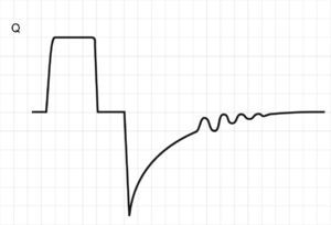 Secretions in the airway. The flow tracing shows characteristic indentations in the expiratory flow curve (more marked with low flows where the signal-to-noise ratio is poorer; solid arrow).