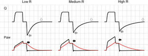 Schematic representation of the effect of increased resistance during volume-controlled ventilation. During the inspiratory phase in which Q is being controlled by the ventilator, the increase in R gives rise to an increase in the difference between Palv (tracing overlaid upon Paw, in red) and Paw (solid black arrows). In the expiratory phase, the increase in R reduces the peak expiratory flow (solid gray arrows) and increases the time needed for the respiratory system to reach functional residual capacity (hollow arrows). Note that the point where Q reaches 0 coincides with extinction of the Palv–Paw difference.