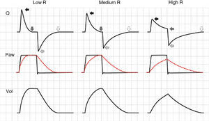 Effect of the increase in resistance during pressure-controlled ventilation. The increase in R leads to a reduction in peak inspiratory (solid black arrows) and expiratory flow (solid light arrows), while the time required for flow to reach 0 during inspiration (solid dark arrows) and during expiration (hollow arrows) increases. It can be seen that the same phenomenon determining the appearance of auto-PEEP during expiration induces a decrease in tidal ventilation (TV) during inspiration.