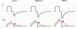 Effect of the increase in elastance during volume-controlled ventilation. During inspiration, the increase in E results in an increase in airway pressure, though in contrast to the situation observed with increases in R, there is no rise in the pressure gradient between Paw and Palv (solid arrows). During expiration, the rise in E increases the peak expiratory flow (hollow arrows).