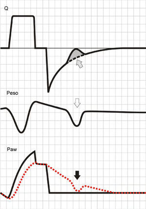 Ineffective inspiratory efforts. Schematic representation of the esophageal pressure (Peso) and flow tracings in the context of patient inspiratory effort. In the Peso tracing, note that in addition to the effort which starts an inspiratory cycle, there is a second effort that proves ineffective (hollow arrow). The observed drop in Palv (tracing overlaid upon the Paw tracing; solid black arrow) is unable to invert the Palv–Paw gradient and thus invert the flow. However, the gradient reduction results in a lowering of the flow that reveals the presence of the phenomenon (solid gray arrow).
