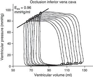 Example of a series of pressure–volume loops in an animal model, obtained through progressive occlusion of the inferior vena cava. Ees, end-systolic elastance.