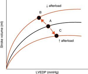 Effect of changes in afterload on the Frank-Starling curves. An increase in afterload lowers the stroke volume and increases left ventricle end-diastolic pressure (LVEDP) (displacement of points A to C). A decrease in afterload increases stroke volume and lowers LVEDP (displacement of points A to B). LVEDP, left ventricle end-diastolic pressure.