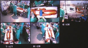 Camera views during simulated initial trauma management.