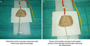Performance of training model for ultrasound-guided vascular cannulation.