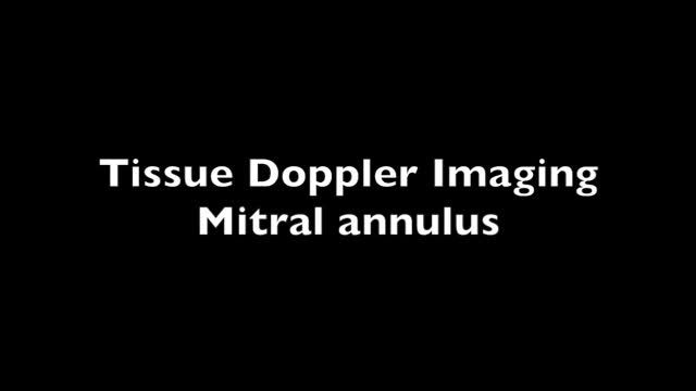https://ars.els-cdn.com/content/image/1-s2.0-S2173572716300509-mmc3.mp4