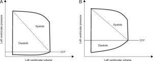 Pressure–volume curves of a healthy subject (A) and a patient with diastolic dysfunction (B), note the increase of end-diastolic pressure (EDP) for the same end-diastolic volume in case of diastolic dysfunction.