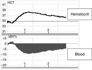 Changes in blood volume in plasmapheresis with albumin replacement fluid using an online volume monitor. Variation in blood volume (Crit-Line®). Starting plasmapheresis in a patient with a myasthenic crisis and replacement with 5% albumin solution. There is an abrupt drop in blood volume (about 10%), probably mediated by the transfer of fluids from the vascular space to the interstitial space due to the drop in the colloid osmotic pressure.
