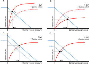 Relationship between changes in central venous pressure and cardiac output. Central venous pressure (CVP) is defined by the relationship between the right ventricular function (red) and venous return curves (blue). Intersection of both curves (black dot) determines a unique value of CVP and cardiac output. Changes in cardiac output and CVP in the same direction mainly reflect variations in the venous return (peripheral function). Changes in cardiac output and CVP in opposite directions are usually the result of a variation in cardiac function (central function). A: cardiac function improvement; B*: cardiac function worsening; C: venous return increase; D: venous return decrease. *In this particular scenario, an increase in extravascular pressure should be also considered (air trapping, intraabdominal hypertension, etc.). In these circumstances, transmural pressure and cardiac preload could be reduced.