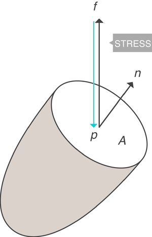 Stress=pressure. Source: Reproduced with permission Modesto-Alapont et al.5