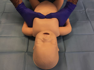 ‘Hugging’ technique using both hands.
