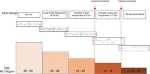 Changes seen in the morphology of electroencephalographic waves as the cerebrospinal fluid (CSF) decreases.