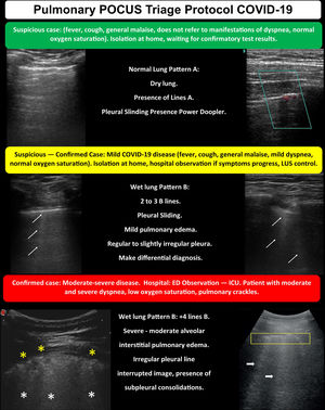 POCUS triage protocol for COVID-19.