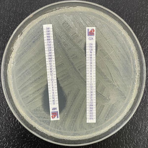 KPC-31 producing Klebsiella pneumoniae resistant to ceftazidime-avibactam (CZA) and with a meropenem minimum inhibitory concentration (MIC) smaller than that which would correspond to the related conventional carbapenemase KPC-3.