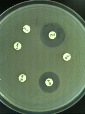 Pseudomonas aeruginosa, isolation of metallo-β-lactamase producer. The association with dipicolinic acid (DP) and/or EDTA (OE) restores sensitivity to meropenem (MRP) and/or imipenem (IMI).