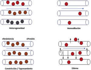 Alteraciones de la microcirculación asociadas con la pérdida de la coherencia hemodinámica. Las alteraciones que conllevan la pérdida de la coherencia hemodinámica conducen a hipoxia tisular. Heterogeneidad capilar: la presencia de capilares permeables al lado de otros obturados resulta en una oxigenación heterogénea del tejido. Hemodilución: la resucitación lleva a la hemodilución, y ello hace que haya menor proporción de hematíes, por lo que hay menor proporción de transporte de oxígeno. Constricción/taponamiento: las sustancias inflamatorias alteran la regulación del tono vascular, que altera el flujo capilar y, por ende, genera anormalidades de la presión hidrostática y oncótica que conllevan una alteración en la difusión del oxígeno tisular. Edema: secundario a una situación de fuga capilar, acaba por empeorar el transporte de oxígeno por alteración de la correcta circulación del hematíe.