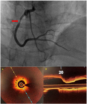 Cardiac catheterization and Optical coherence tomography (OCT).