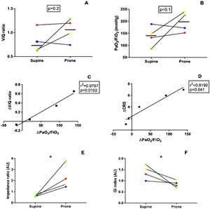 Individual changes in dorsal ventilation/perfusion ratios (V/Q, A) and oxygenation (PaO2/FIO2, B) and from supine to prone positioning in the dorsal lung regions. Relationships between changes in PaO2/FIO2 and V/Q ratios of the dorsal lung regions are represented in C and between changes in PaO2/FIO2 and the CRS in panel D. A different color represents each patient. Changes in EIT indices are shown in E and F. V: ventilation: Q: perfusion; PaO2: arterial partial pressure of oxygen; FIO2: fraction of inspired oxygen, CRS: Respiratory system compliance, GI: global inhomogeneity index, AU: arbitrary units, * = p < 0.05.