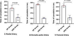 A Box plot diagram showing a comparison of Time of cannulation in ultrasound versus DP in (seconds, mean ± SD) in patients with VIS SCORE > 10 (n = 63). Time for cannulation in USG group was significantly reduced compared to DP group in radial, femoral and dorsalis pedis artery in patients with VIS > 10 (Radial artery: USG vs. DP, P < .001; Femoral artery: USG vs. DP, P < .001; Dorsalis pedis artery: USG vs. DP, P < .001). VIS: Vasoactive inotrope score. USG Group: ultrasound-guided group, DP Group: direct palpation group.