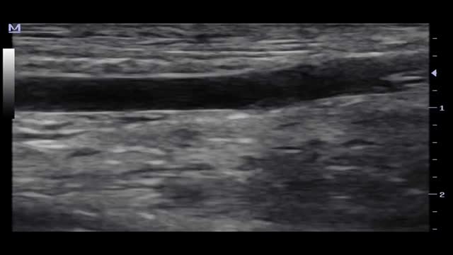 https://ars.els-cdn.com/content/image/1-s2.0-S2173572723000796-mmc6.mp4