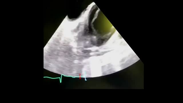 https://ars.els-cdn.com/content/image/1-s2.0-S217357272300139X-mmc1.mp4