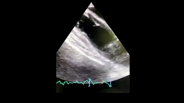 https://ars.els-cdn.com/content/image/1-s2.0-S217357272300139X-mmc2.mp4